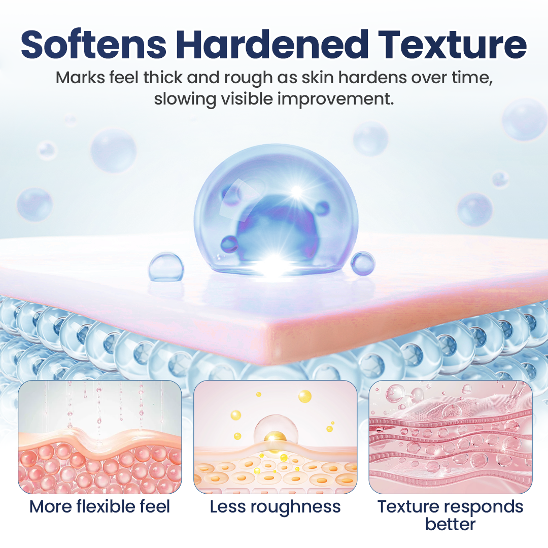 Tiworld® Texture Repair Gel