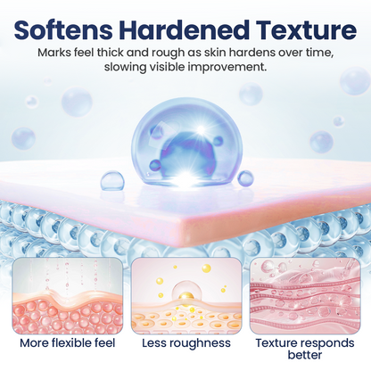 Tiworld® Texture Repair Gel