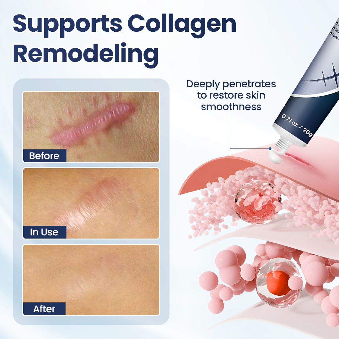 Tiworld® Texture Repair Gel