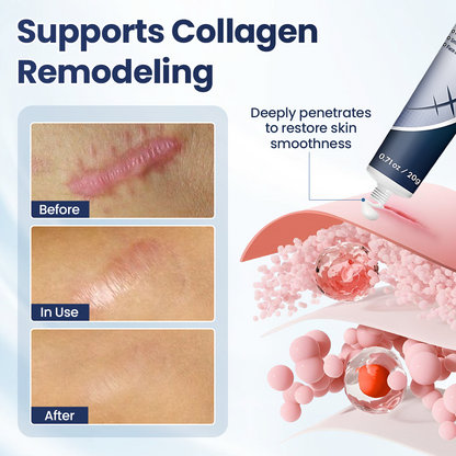 Tiworld® Texture Repair Gel